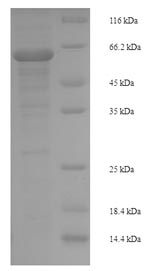 Human MAPK9 protein