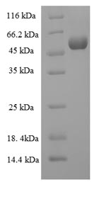 Human MMP13 protein