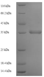 Human MPV17 protein