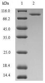 Human MTHFR protein