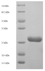 Human NDUFB5 protein