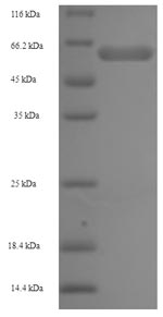 Human OGDH protein