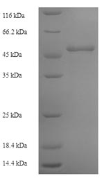 Human OTC protein