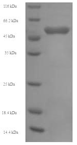 Human OXCT1 protein