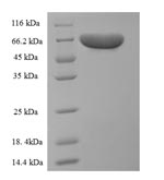 Rat Pklr protein