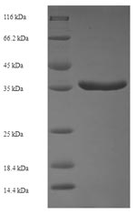 Human PPM1B protein