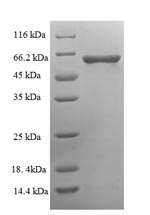 Human PPP3CC protein