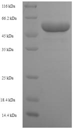 Human PRPS1 protein