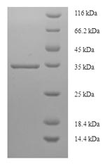 Human PTGDS protein