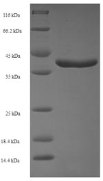 Human RAB11A protein