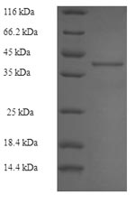 Human RAB27B protein