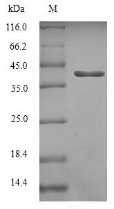 Human RAB5C protein