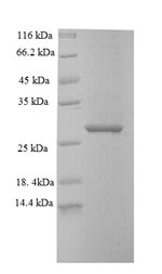 Mouse SAMHD1 protein