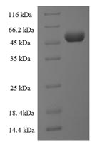 Human SLC27A2 protein