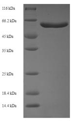 Human SNPH protein