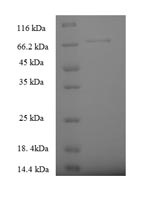Human SPTLC2 protein