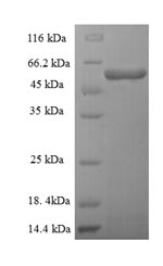 Human TARS2 protein