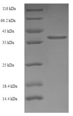 Human TMEM141 protein