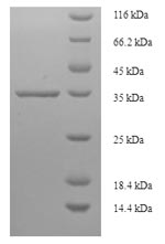 Human TPD52 protein