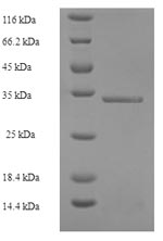 Human UBD protein
