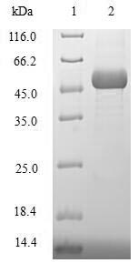 Human XRCC3 protein