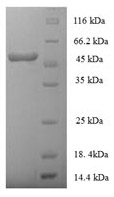 Human HLA-E protein