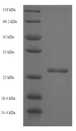 E.coli vpx protein