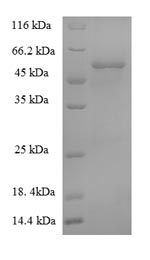 E.coli AC1 protein