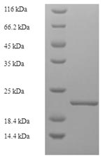 E.coli Car b 1 isoforms 1A and 1B protein