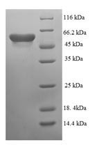 E. coli codA protein