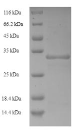 E. coli cssB protein