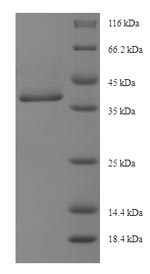 Human MAP3K7CL protein