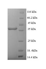 E.coli SEH protein