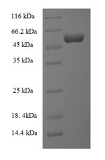E. coli yciM protein