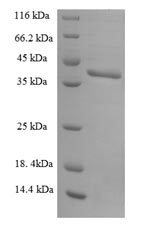 Human SNRPB2 protein