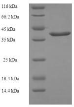 E. coli cmk protein