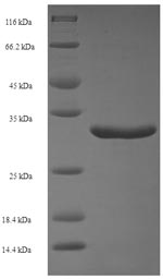 E.coli nosM protein