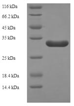 E.coli ykuP protein