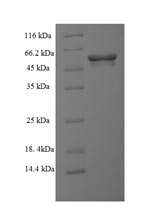 E.coli sacIM protein