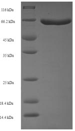 E.coli hmt2 protein