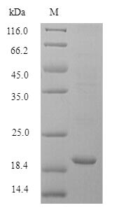 Mouse Fhit protein
