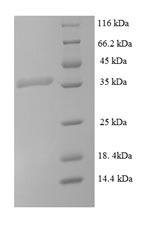 E.coli lepB protein