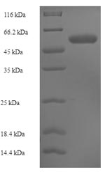 Human ST3GAL3 protein
