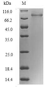 Human RBMY1F protein