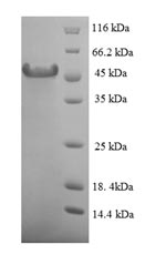 Human HABP2 protein