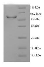 Human NR1I3 protein
