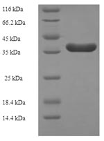 Human CBFB protein