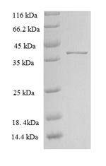 Rat Slc39a13 protein