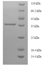 Human PDLIM3 protein