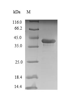Rat Nqo2 protein